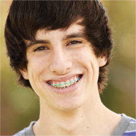A teenage boy with braces, smiling